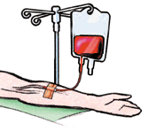Transfusion-sanguinea-02.gif
