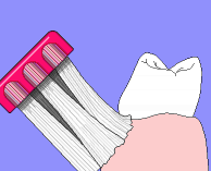 Diente-15.gif