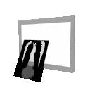 Rayos-X-27.gif