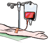 Transfusion-sanguinea-02.gif